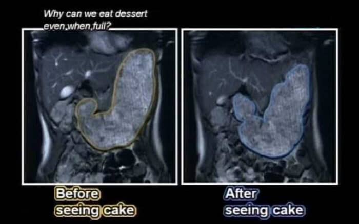 Diagram of stomach before and after dessert 